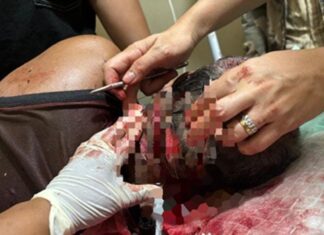 Terjadi Pengeroyokan Kepada Darmawi Hingga Luka Parah, Keluarga Desak Polisi Tangkap Pelaku